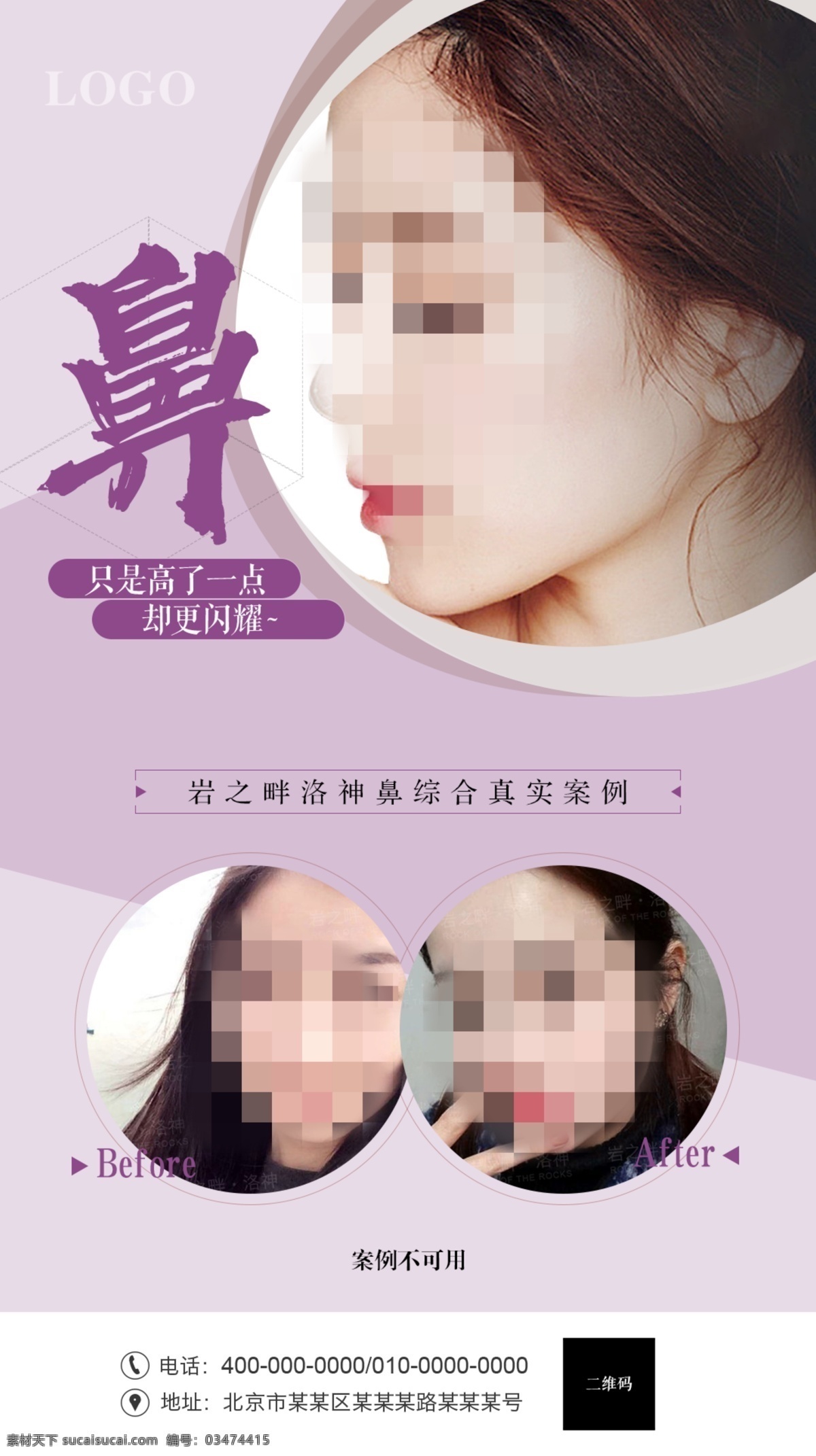 隆鼻 整形 醫(yī)美 醫(yī)學(xué)美容 整形海報(bào) 美容整形 整形美容 美女 醫(yī)美整形海報(bào) 微整形 微整形海報(bào) 玻尿酸 美容海報(bào) 面部整形 韓式整形 整形醫(yī)院 面部美學(xué) 面部微整形 面部微雕 抗衰 抗衰老 美鼻 面部線雕 線雕 祛斑 美白 瘦臉 祛痘 面雕 美容 醫(yī)美整形 整形美容海報(bào) 醫(yī) 美 移動(dòng) 端 海報(bào)
