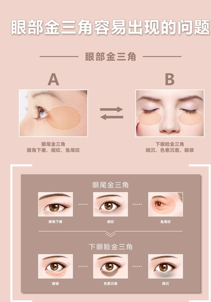 眼部金三角 眼部 金三角 皮膚 問題 眼睛 皺紋