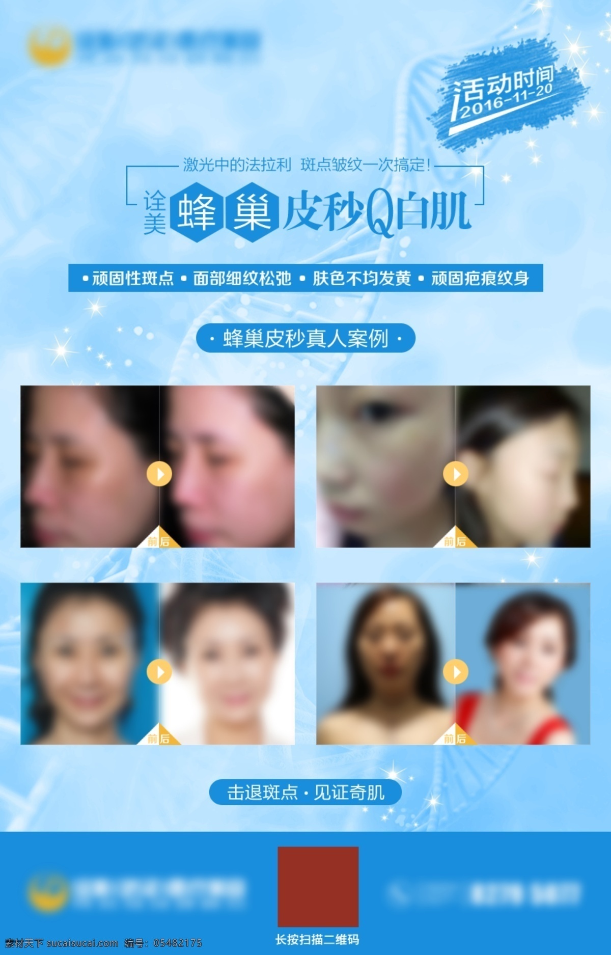 皮 秒 激光美容 儀 海報(bào) 皮秒美容海報(bào) 皮秒祛斑 蜂巢皮秒激光 抗衰老 蜂巢科技 皮秒激光 易拉寶 皮秒 皮秒展架 智能 激光 光學(xué)美容醫(yī)療 韓式半永久 半永久 光學(xué)美療 光學(xué) 美療 美容醫(yī)療 醫(yī)療 光學(xué)美容 祛斑 祛斑儀器 光學(xué)美膚 美容儀器 光學(xué)美膚儀器 美膚儀器 美白 整形美容 分層