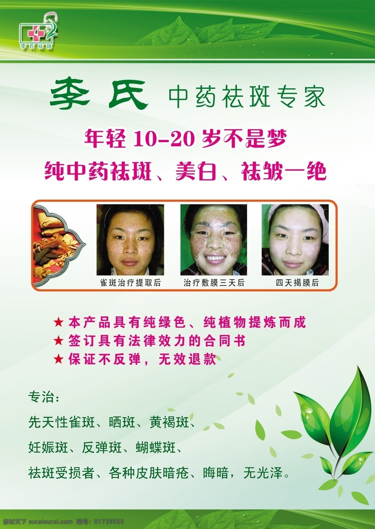 祛斑 招牌 招贴设计 祛斑招牌 纯绿色 纯植物 中医祛斑 中药祛斑 海报 其他海报设计