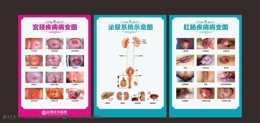 病变示意图 宫颈疾病示 宫颈 宫颈图 宫颈病变 宫颈病变图 宫颈糜烂图 宫颈糜烂 正常宫颈 宫颈息肉 宫颈肥大 妇科 妇科挂图 矢量图库 医疗广告 解剖图科室图