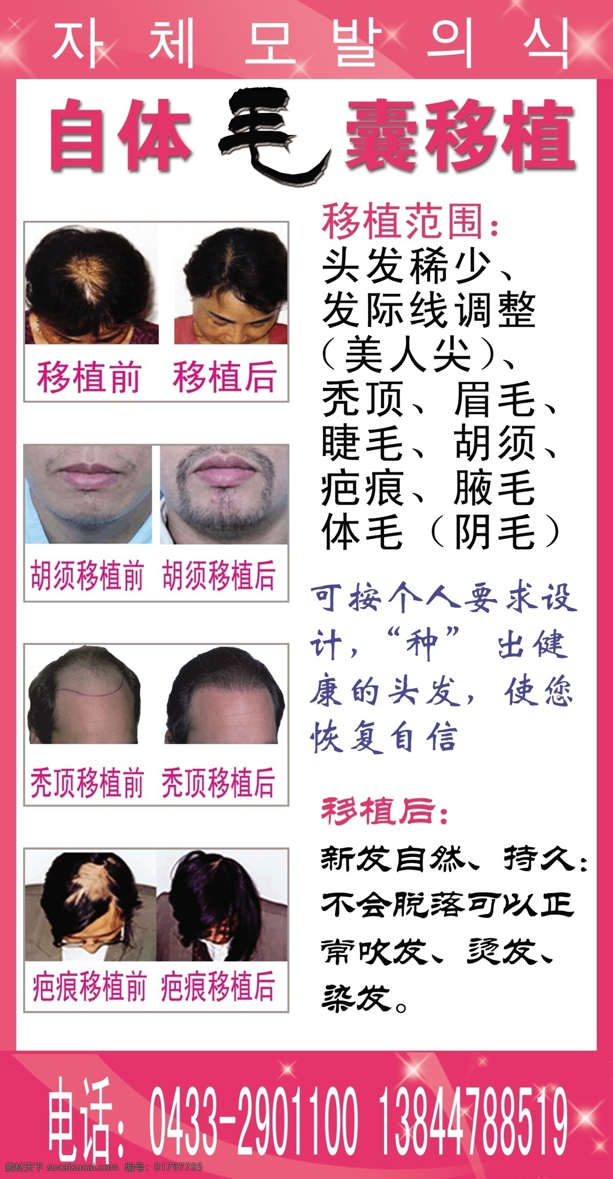 广告设计模板 美容院素材 头发 医院展板 源文件 展板 展板模板 展板素材 整容素材 种睫毛 自体 毛囊 移植 其他展板设计