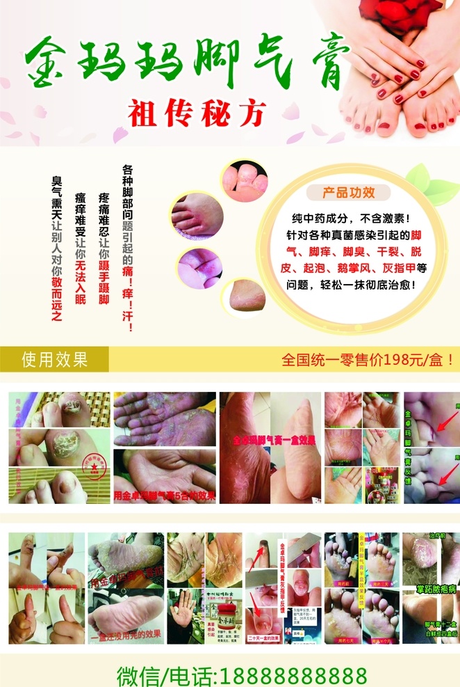 脚气膏海报 脚气膏 海报 绿色 养生 对比图