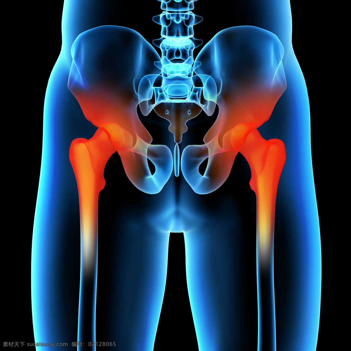 腿 关节痛 人体骨头 腿关节 关节炎 人体器官 医疗护理 现代科技