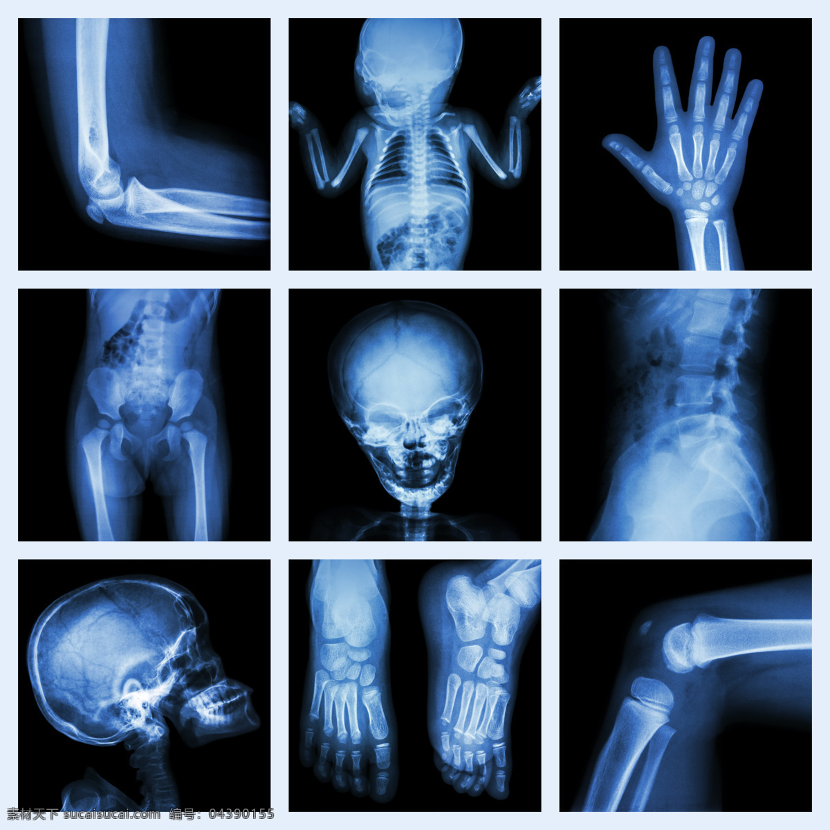 人体 各种 部门 透视图 医疗护理 医学研究 x光片 x光片图片 x 光 片 医疗 拍片 医学研究素材 护理 图片库 光片 轮廓 透视 医用 结构 骨骼 现代科技