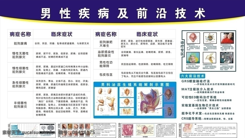 男科疾病挂图 男科疾病 医院挂图 前列腺炎 前列腺疾病