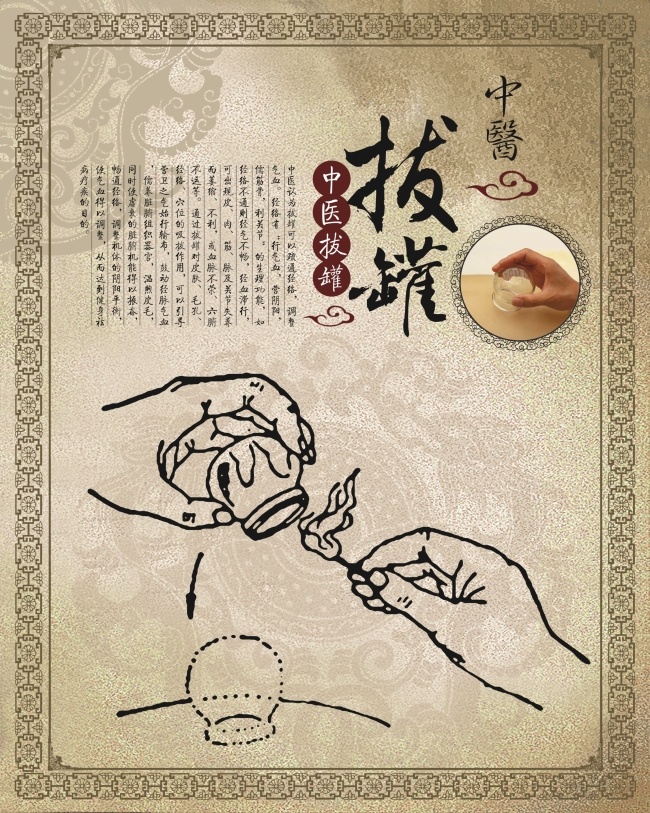拔罐 宣传海报 矢量图 中医药素材 拔罐宣传海报 中医海报素材 拔罐素材 拔火罐 宣传单 彩页 dm
