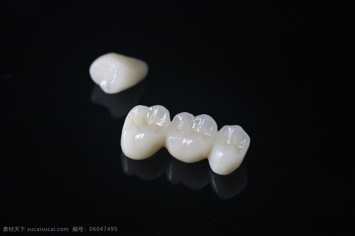 牙齿 假牙 义齿 氧化锆烤瓷牙