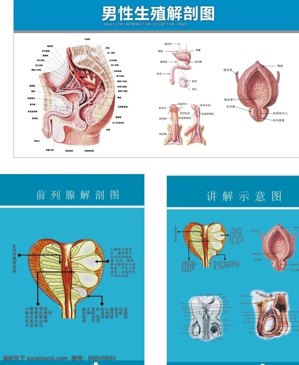 医院 男科 解 破 图 解破图 医疗 生殖 器官 男科墙报 男科背景 蓝色 医院展板 男科展板 矢量