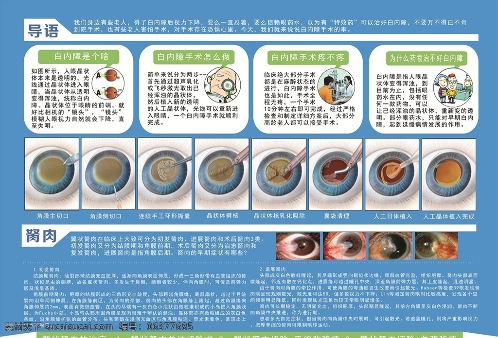 眼科 白内障 单 页 单页 义诊单 医院 dm宣传单