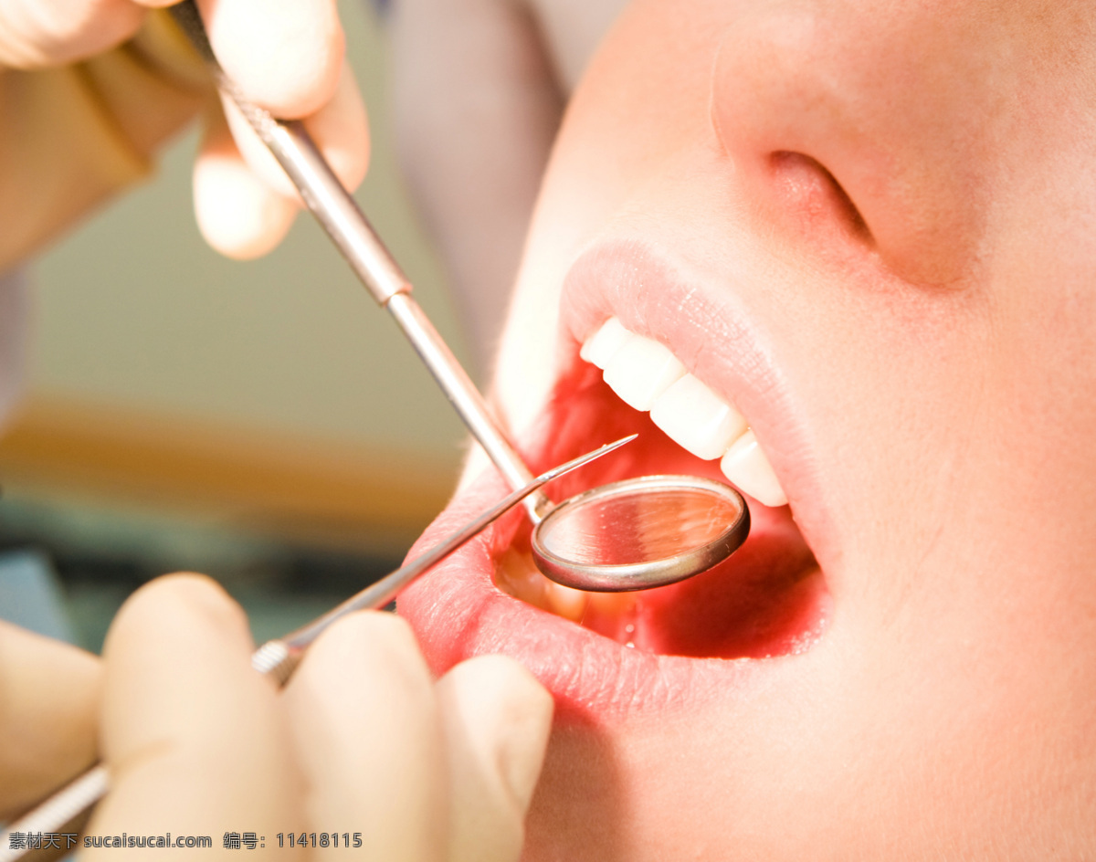 口腔护理 洁白牙齿 口镜 探针检查 牙科 牙医