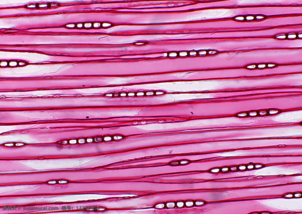 紫红色 带状 细胞 晶 细胞结晶图片 微观世界 细胞单元 结晶