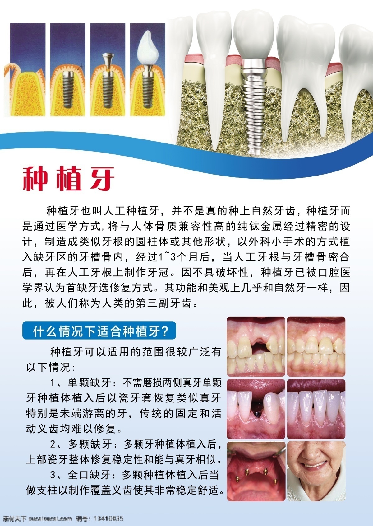 牙科诊所展板 牙齿 牙 牙科 口腔 修牙 补牙 洗牙 拔牙 治牙 牙医口腔 牙齿诊所 口腔诊所 分层