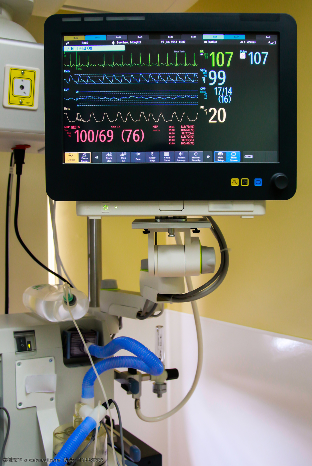 医院心电图 心电图 医院 医疗设备 医疗器械 心率 测量 高清心电图 现代科技 医疗护理